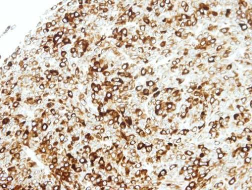 STAP2 Rabbit Polyclonal Antibody