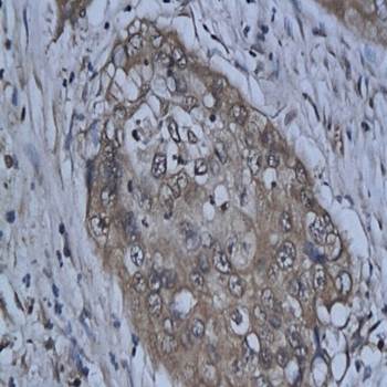 Phospho-STAT5a (Tyr694) Rabbit Polyclonal Antibody