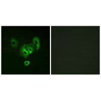 STEAP2 Antibody