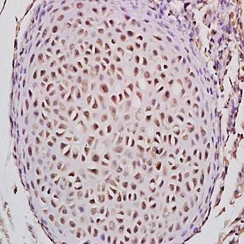 STEAP4 Rabbit Polyclonal Antibody