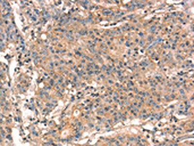 STK17A Antibody