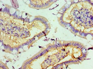 STK3 Antibody