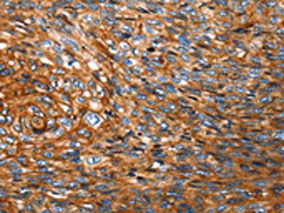 STK33 Antibody