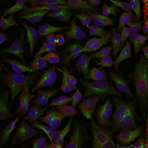 STMN1 Antibody