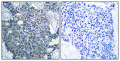 STMN1 Antibody