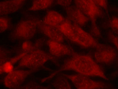 STMN1 Antibody