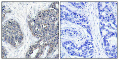 STMN1 Antibody