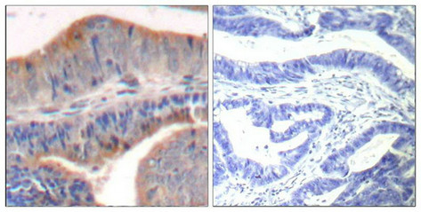 STMN1 Antibody