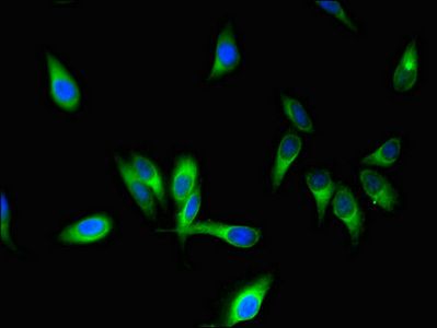STMN1 Antibody