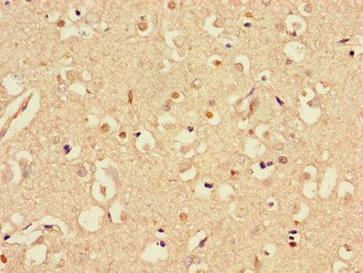 STMN1 Antibody