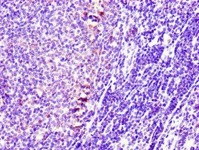STMN1 Antibody