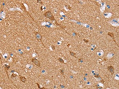 STMN1 Antibody