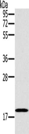 STMN1 Antibody