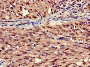 STOML3 Antibody