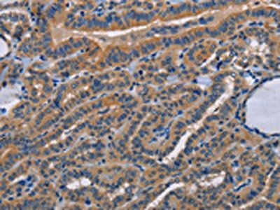 STRADB Antibody