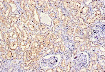 MMP10 Antibody