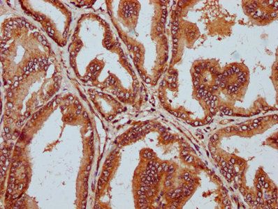 STT3B Antibody