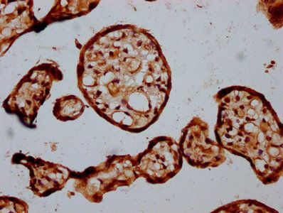STT3B Antibody