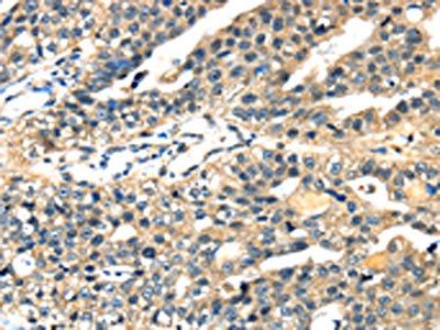 STX7 Antibody