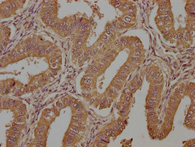 TAC1 Antibody