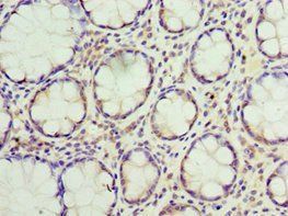 SUMO4 Antibody