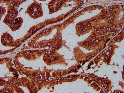SUN2 Antibody