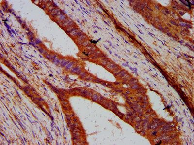 SUN2 Antibody