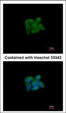 SUOX Rabbit Polyclonal Antibody