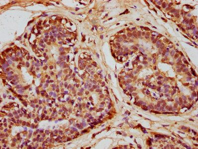 SOD1 Antibody