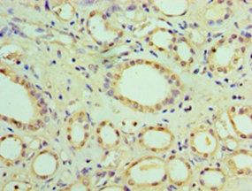 SOCS1 Antibody