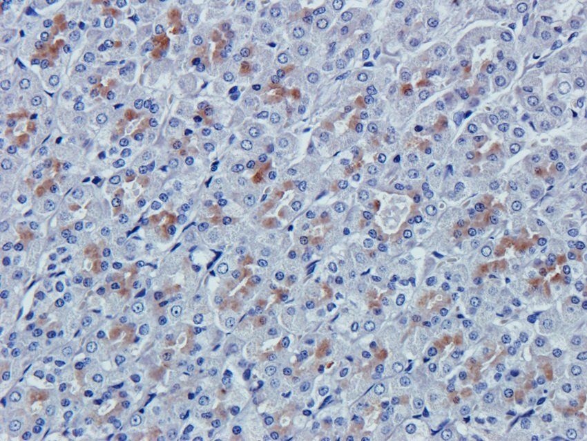 Syndecan 1 Rabbit Polyclonal Antibody