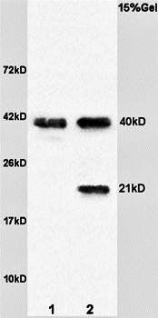 Syndecan 4 Rabbit Polyclonal Antibody