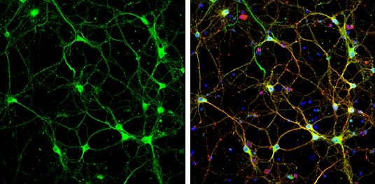 Syntaxin 4 Rabbit Polyclonal Antibody