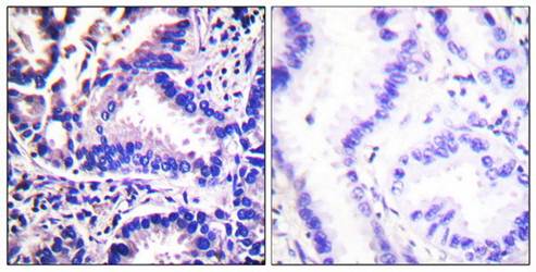 Synuclein γ Antibody