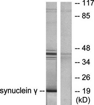 Synuclein γ Antibody