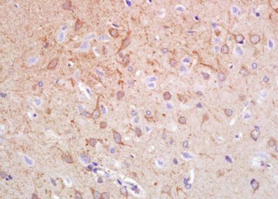 Synphilin-1 Rabbit Polyclonal Antibody