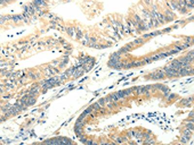 SYT5 Antibody