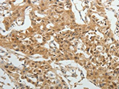 SYT6 Antibody