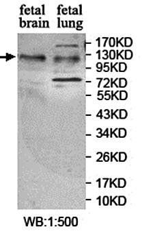 SZT2 Rabbit Polyclonal Antibody
