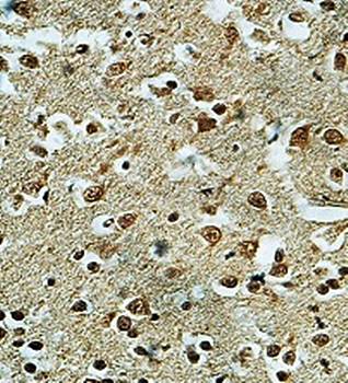 SZT2 Rabbit Polyclonal Antibody