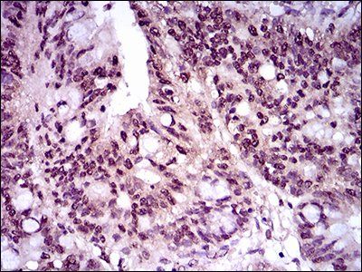 T Antibody