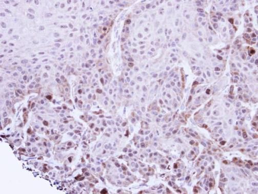 TACC2 Rabbit Polyclonal Antibody
