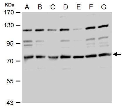 TACC2 Rabbit Polyclonal Antibody