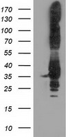 TACC3 Antibody
