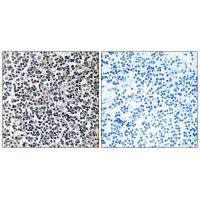 TACC3 Antibody