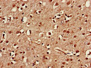 TAF1A Antibody