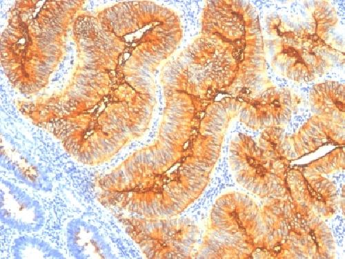 TAG-72 / CA72.4 (Tumor-Associated Glycoprotein) Antibody