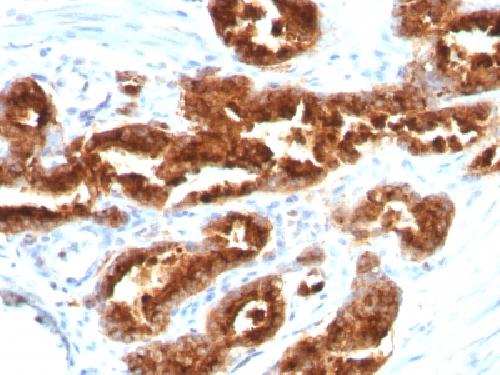 TAG-72 / CA72.4 (Tumor-Associated Glycoprotein) Antibody
