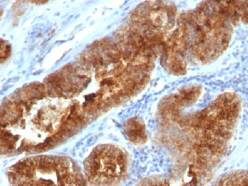 TAG-72 / CA72.4 (Tumor-Associated Glycoprotein) Antibody
