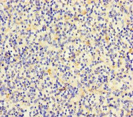 TLN2 Antibody